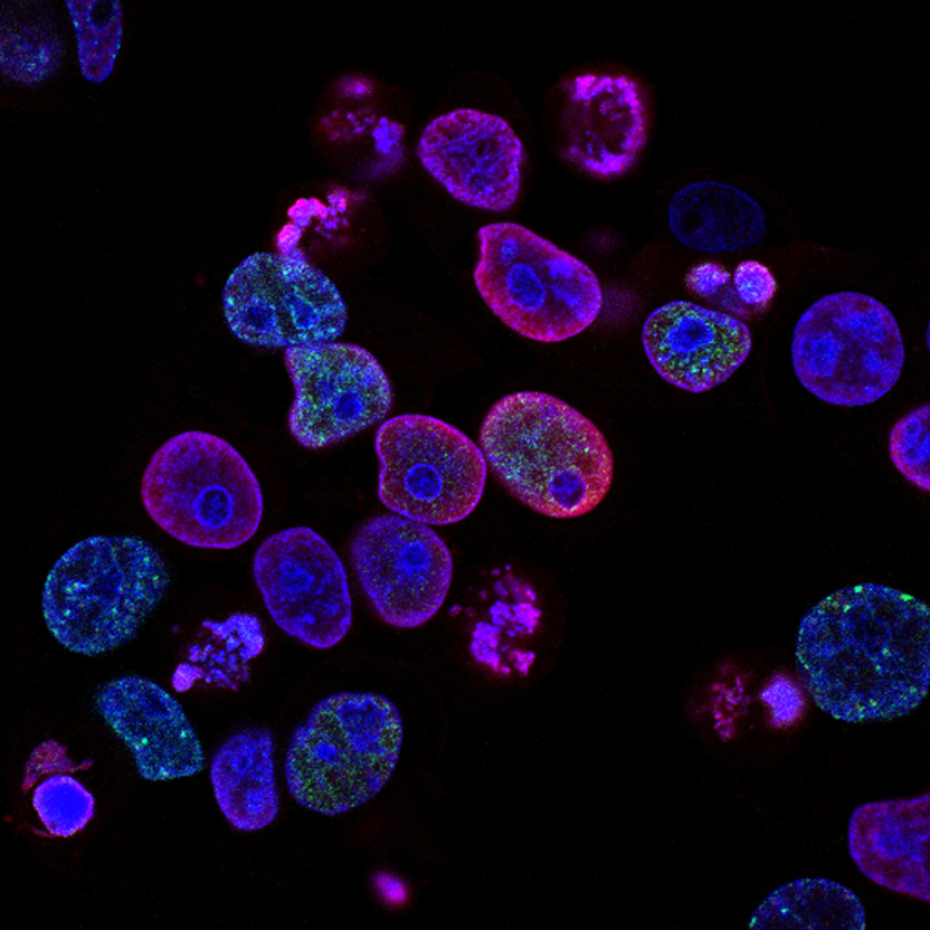 https://visualsonline.cancer.gov/details.cfm?imageid=9888